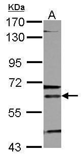 ALAS-E Rabbit Polyclonal Antibody