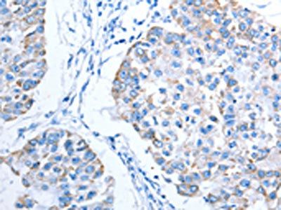 ALAS1 Antibody