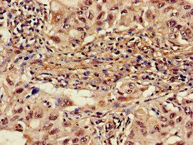 ALAS1 Antibody