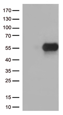 ALAS2 antibody