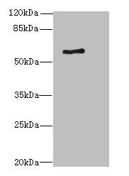 ALAS2 antibody