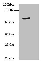 ALAS2 Antibody