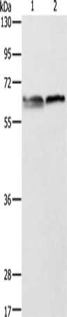 ALAS2 Antibody