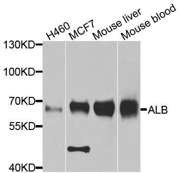 ALB antibody