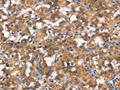 ALCAM Antibody