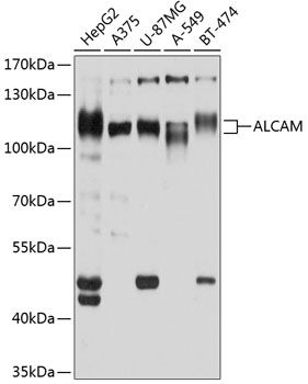 ALCAM antibody