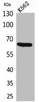 ALCAM antibody