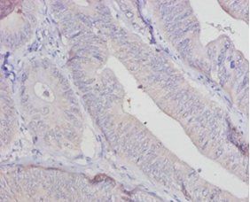 AOX1 Antibody
