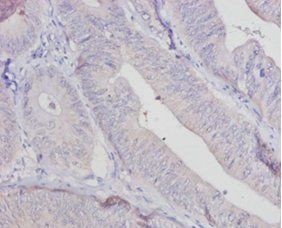 Aldehyde oxidase antibody