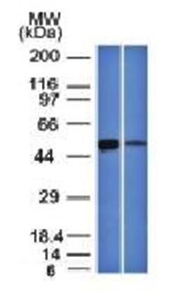 ALDH1A1 (Aldehyde Dehydrogenase 1A1) Antibody