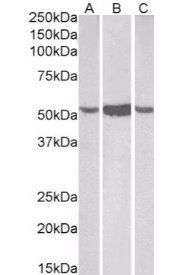 ALDH1A1 antibody