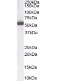ALDH1A1 antibody