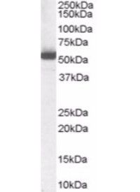 Goat anti-ALDH1A1 (Internal) Antibody
