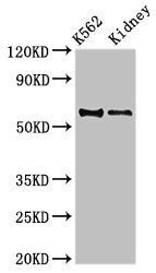 ALDH1A2 antibody