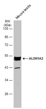 ALDH1A2 Rabbit Polyclonal Antibody