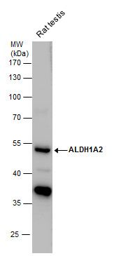 ALDH1A2 Rabbit Polyclonal Antibody