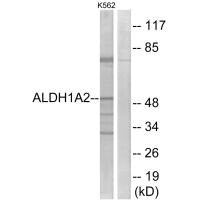 ALDH1A2 antibody