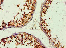 ALDH1B1 Antibody