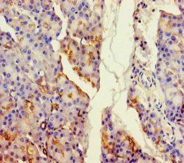 ALDH1L2 Antibody