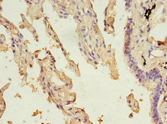 ALDH3A1 Antibody