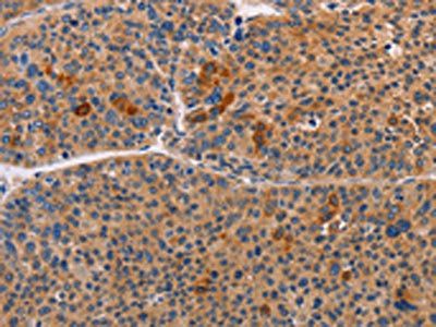 ALDH3A1 Antibody