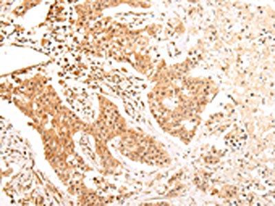 ALDH3A2 Antibody
