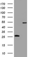 ALDH3B1 antibody