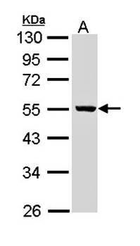 ALDH3B2 antibody