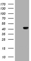 ALDH4A1 antibody