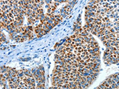 ALDH4A1 Antibody