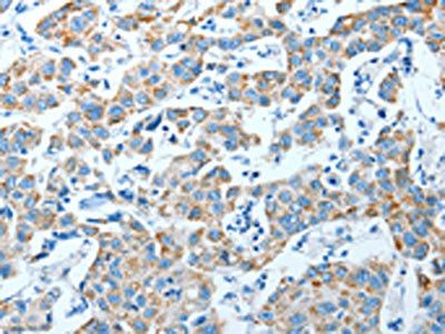 ALDH4A1 Antibody