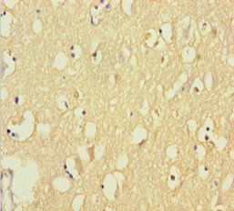 ALDH5A1 Antibody