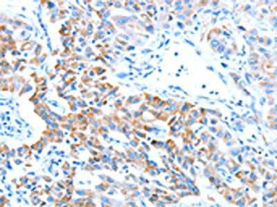 ALDH5A1 Antibody
