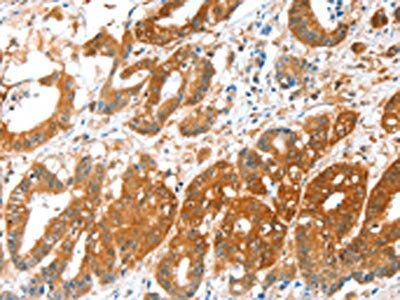 ALDH5A1 Antibody