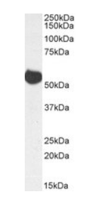Goat anti-ALDH5A1 (aa 485-496), Biotinylated Antibody