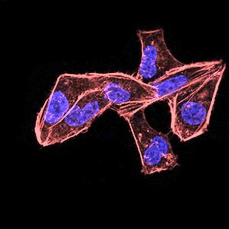 ALDH6A1 Antibody