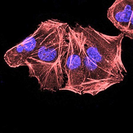 ALDH6A1 Antibody