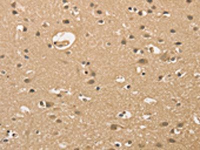 ALDH8A1 Antibody