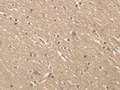 ALDH8A1 Antibody