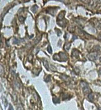 ALDH8A1 Rabbit Polyclonal Antibody