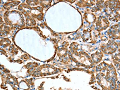 ALDH9A1 Antibody