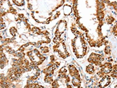 ALDH9A1 Antibody
