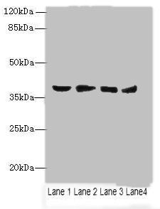 Aldo-keto reductase family 1 member C2 antibody