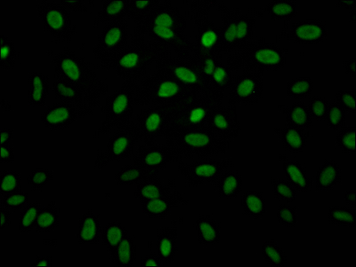 ALDOA Recombinant Monoclonal Antibody