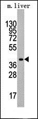 ALDOA antibody
