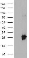 ALDOB Antibody