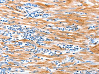 ALDOB Antibody