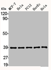 ALDOB Antibody