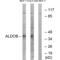 ALDOB Antibody