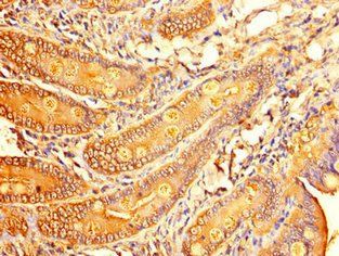 ALDOC Antibody